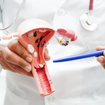 Cervical Cancer Myths and Facts - Dr. Madhu Goel