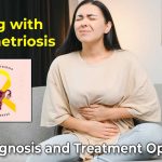 Endometriosis: Diagnosis and Treatment Options