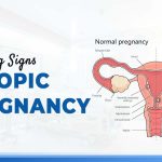 Ectopic pregnancy symptoms