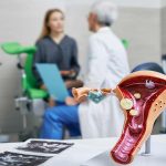 cervical cancer screening