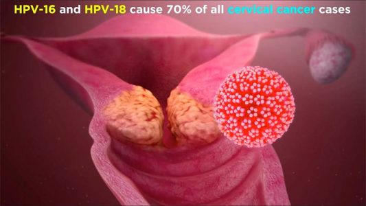 HPV 16 and 18 cause majority of cervical cancer cases