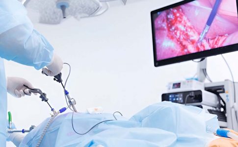 Diagnostic laparoscopy and gynaecological operations