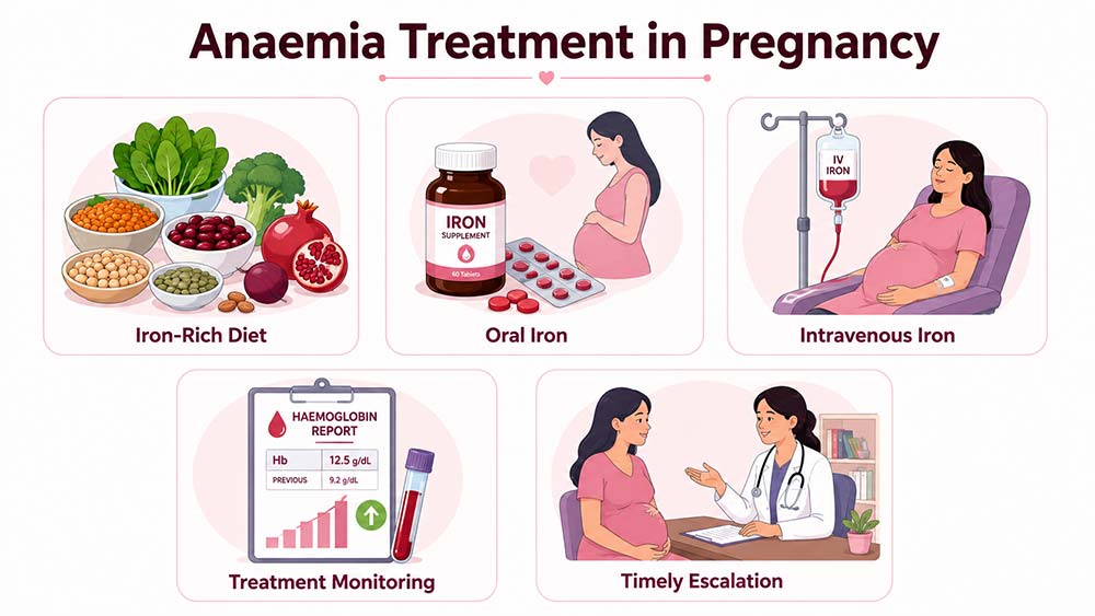 Anaemia treatment in pregnancy including diet, iron, monitoring, escalation options.